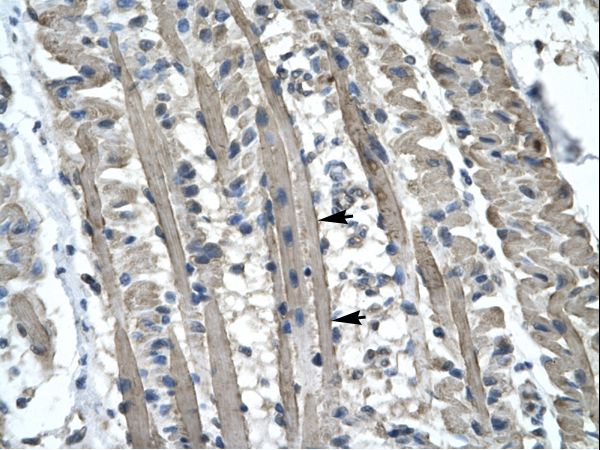 Kinesin Heavy Chain / KIF5B Antibody - KIF5B antibody ARP33904_P050-NP_004512-KIF5B (kinesin family member 5B) Antibody was used in IHC to stain formalin-fixed, paraffin-embedded human muscle.  This image was taken for the unconjugated form of this product. Other forms have not been tested.