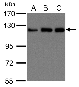 Kinesin Heavy Chain / KIF5B Antibody - Sample (30 ug of whole cell lysate). A:293T, B: A431 , C: H1299. 15% SDS PAGE. Kinesin Heavy Chain / KIF5B antibody diluted at 1:1500.