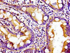 Kinesin Heavy Chain / KIF5B Antibody - Immunohistochemistry image of paraffin-embedded human small intestine tissue at a dilution of 1:100