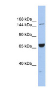 Kinesin-Like 7 / KIF15 Antibody - KIF15 antibody Western blot of COLO205 cell lysate. This image was taken for the unconjugated form of this product. Other forms have not been tested.