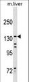 Kinesin-Like 7 / KIF15 Antibody - KIF15 Antibody western blot of mouse liver tissue lysates (35 ug/lane). The KIF15 antibody detected the KIF15 protein (arrow).