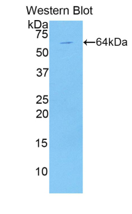 KIR2DL1 / CD158a Antibody - Western blot of recombinant KIR2DL1 / CD158a.  This image was taken for the unconjugated form of this product. Other forms have not been tested.