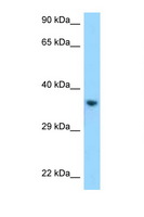 KIR2DL1 / CD158a Antibody - KIR2DL1 antibody Western blot of HepG2 Cell lysate. Antibody concentration 1 ug/ml.  This image was taken for the unconjugated form of this product. Other forms have not been tested.