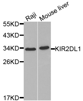 KIR2DL1 / CD158a Antibody - Western blot analysis of extracts of various cell lines, using KIR2DL1 antibody at 1:1000 dilution. The secondary antibody used was an HRP Goat Anti-Rabbit IgG (H+L) at 1:10000 dilution. Lysates were loaded 25ug per lane and 3% nonfat dry milk in TBST was used for blocking.