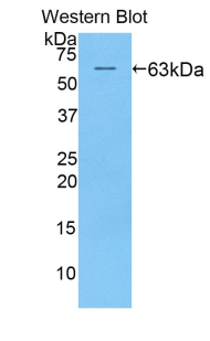 KIR2DL2 / CD158b Antibody - Western blot of recombinant KIR2DL2 / CD158b.  This image was taken for the unconjugated form of this product. Other forms have not been tested.