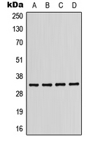 KIR2DL2 / CD158b Antibody - Western blot analysis of CD158b1 expression in MDAMB231 (A); Jurkat (B); mouse liver (C); H9C2 (D) whole cell lysates.
