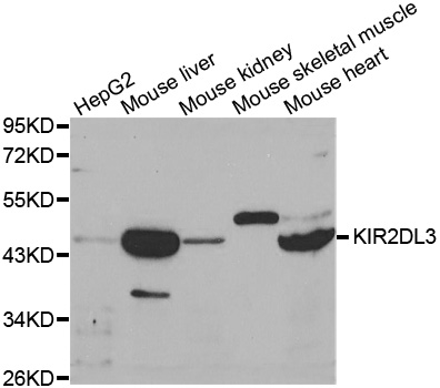 KIR2DL3 / CD152B2 Antibody - Western blot analysis of extracts of various cell lines, using KIR2DL3 antibody at 1:1000 dilution. The secondary antibody used was an HRP Goat Anti-Rabbit IgG (H+L) at 1:10000 dilution. Lysates were loaded 25ug per lane and 3% nonfat dry milk in TBST was used for blocking.