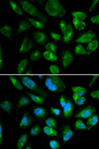 KIR2DL3 / CD152B2 Antibody - Immunofluorescence analysis of HepG2 cells using KIR2DL3 antibody. Blue: DAPI for nuclear staining.