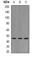 KIR2DL3 / CD152B2 Antibody - Western blot analysis of CD158b2 expression in HepG2 (A); mouse liver (B); mouse heart (C) whole cell lysates.