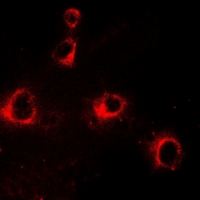 KIR2DL3 / CD152B2 Antibody - Immunofluorescent analysis of CD158b2 staining in HepG2 cells. Formalin-fixed cells were permeabilized with 0.1% Triton X-100 in TBS for 5-10 minutes and blocked with 3% BSA-PBS for 30 minutes at room temperature. Cells were probed with the primary antibody in 3% BSA-PBS and incubated overnight at 4 deg C in a humidified chamber. Cells were washed with PBST and incubated with a DyLight 594-conjugated secondary antibody (red) in PBS at room temperature in the dark.