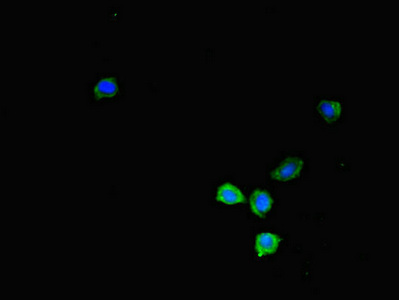 KIR2DL3 / CD152B2 Antibody - Immunofluorescent analysis of HepG2 cells diluted at 1:100 and Alexa Fluor 488-congugated AffiniPure Goat Anti-Rabbit IgG(H+L)