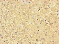 KIR2DL3 / CD152B2 Antibody - Immunohistochemistry of paraffin-embedded human liver tissue at dilution of 1:100