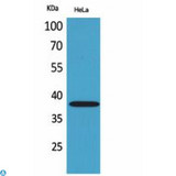 KIR2DL3 / CD152B2 Antibody - Western Blot (WB) analysis of HeLa cells using CD158b2/j polyclonal antibody.