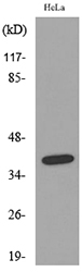 KIR2DL3 + KIR2DS2 Antibody - Western blot analysis of lysate from HeLa cells, using KIR2DL3/KIR2DS2 Antibody.