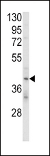 KIR2DL4 Antibody - Western blot of KIR2DL4 Antibody in MDA-MB231 cell line lysates (35 ug/lane). KIR2DL4 (arrow) was detected using the purified antibody.