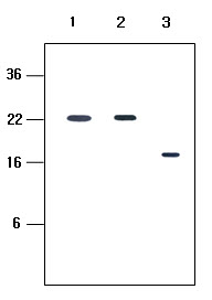 KIR2DL4 Antibody - Human recombinant protein KIR2DL1, KIR2DL3 and KIR2DL4 (each 20 ng per well) were resolved by SDS-PAGE, transferred to PVDF membrane and probed with anti-human KIR2DL4 (1:500). Proteins were visualized using a goat anti-mouse secondary antibody conjugated to HRP and a ECL detection system. Lane 1: Extracellular domain of KIR2DL1(23-223aa); Lane 2: Extracellular domain of KIR2DL3(23-223aa); Lane 3: Extracellular domain of KIR2DL4(44-202aa).