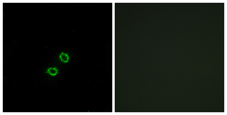 KIR2DL5A / KIR2DL5 Antibody - Immunofluorescence analysis of A549 cells, using KIR2DL5B Antibody. The picture on the right is blocked with the synthesized peptide.