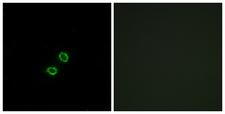 KIR2DL5A / KIR2DL5 Antibody - Immunofluorescence analysis of A549 cells, using KIR2DL5B Antibody. The picture on the right is blocked with the synthesized peptide.