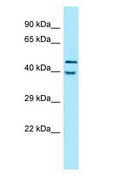 KIR2DL5A / KIR2DL5 Antibody - KIR2DL5A / KIR2DL5 antibody Western Blot of MCF7.  This image was taken for the unconjugated form of this product. Other forms have not been tested.