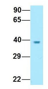 KIR2DL5A / KIR2DL5 Antibody - KIR2DL5A / KIR2DL5 antibody Western Blot of Human Fetal Kidney. Antibody Dilution: 1.0 ug/ml. Antibody dilution: 1 ug/ml.  This image was taken for the unconjugated form of this product. Other forms have not been tested.