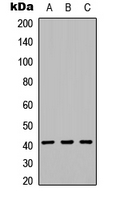 KIR2DL5A / KIR2DL5 Antibody - Western blot analysis of CD158f1 expression in HEK293T (A); NS-1 (B); PC12 (C) whole cell lysates.