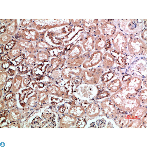 KIR2DL5A / KIR2DL5 Antibody - Immunohistochemical analysis of paraffin-embedded human-kidney, antibody was diluted at 1:200.