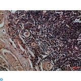 KIR2DL5A / KIR2DL5 Antibody - Immunohistochemical analysis of paraffin-embedded Human-tonsil, antibody was diluted at 1:100.