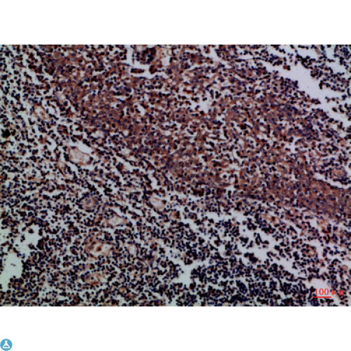 KIR2DL5A / KIR2DL5 Antibody - Immunohistochemical analysis of paraffin-embedded Human-tonsil, antibody was diluted at 1:100.
