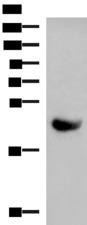 KIR2DL5A / KIR2DL5 Antibody - Western blot analysis of Human plasma solution  using KIR2DL5A Polyclonal Antibody at dilution of 1:1000