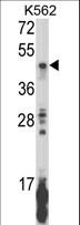 KIR2DL5B Antibody - Western blot of KIR2DL5B Antibody in K562 cell line lysates (35 ug/lane). KIR2DL5B (arrow) was detected using the purified antibody.