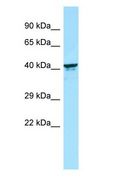 KIR2DL5B Antibody - KIR2DL5B antibody Western Blot of Fetal kidney.  This image was taken for the unconjugated form of this product. Other forms have not been tested.