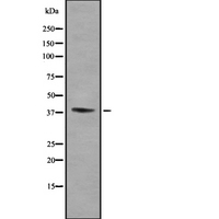 KIR2DL5B Antibody - Western blot analysis of CD158f2 using COLO whole cells lysates