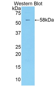 KIR2DS2 / CD158j Antibody - Western blot of recombinant KIR2DS2 / CD158b.  This image was taken for the unconjugated form of this product. Other forms have not been tested.