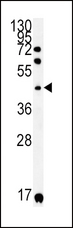 KIR2DS2 / CD158j Antibody - KIR2DS2 Antibody western blot of A2058 cell line lysates (35 ug/lane). The KIR2DS2 antibody detected the KIR2DS2 protein (arrow).