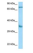 KIR2DS2 / CD158j Antibody - CD158b / KIR2DS2 antibody Western Blot of A549.  This image was taken for the unconjugated form of this product. Other forms have not been tested.