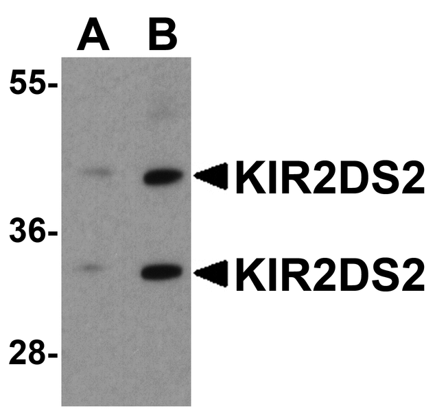 KIR2DS2 / CD158j Antibody - Western blot analysis of KIR2DS2 in 293 cell lysate with KIR2DS2 antibody at (A) 1 and (B) 2 ug/ml.