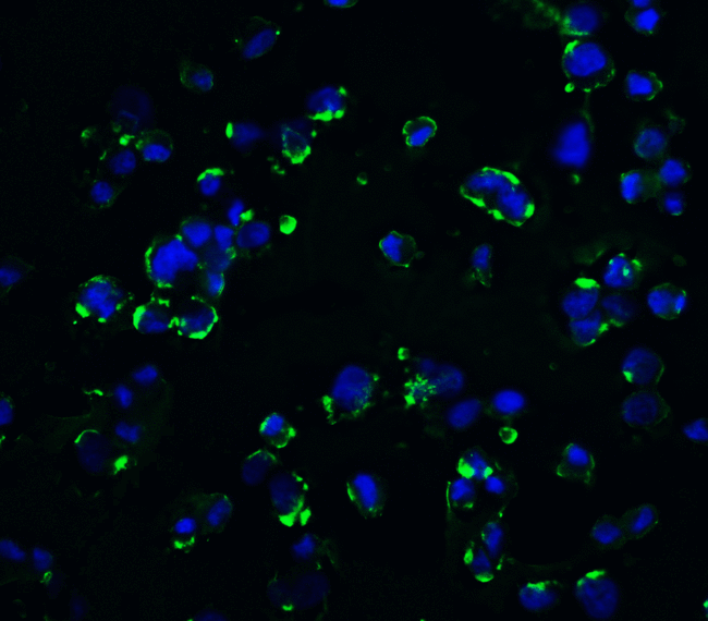 KIR2DS2 / CD158j Antibody - Immunofluorescence of KIR2DS2 in 293 cells with KIR2DS2 antibody at 20 ug/ml.