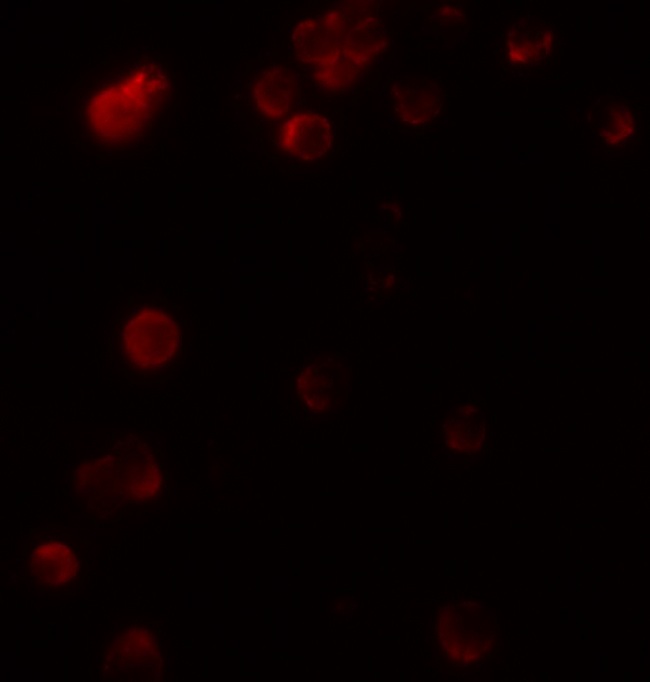 KIR2DS2 / CD158j Antibody - Immunofluorescence of KIR2DS2 in 293 cells with KIR2DS2 antibody at 20 ug/ml.