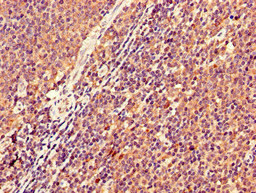 KIR2DS2 / CD158j Antibody - Immunohistochemistry image of paraffin-embedded human lymph node tissue at a dilution of 1:100