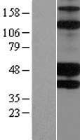KIR2DS2 / CD158j Protein - Western validation with an anti-DDK antibody * L: Control HEK293 lysate R: Over-expression lysate