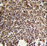 KIR2DS3 Antibody - KIR2DS3 Antibody immunohistochemistry of formalin-fixed and paraffin-embedded human spleen tissue followed by peroxidase-conjugated secondary antibody and DAB staining.