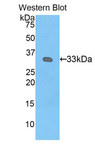 KIR2DS4 Antibody - Western blot of recombinant KIR2DS4.  This image was taken for the unconjugated form of this product. Other forms have not been tested.