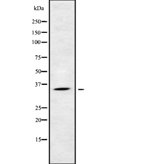 KIR2DS5 Antibody - Western blot analysis of KIR2DS5 using LOVO cells whole cells lysates