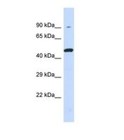 KIR3DL1 Antibody - Western blot of Human 293T. KIR3DL1 antibody dilution 1.0 ug/ml.  This image was taken for the unconjugated form of this product. Other forms have not been tested.