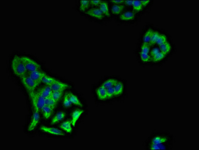 KIR3DL1 Antibody - Immunofluorescent analysis of PC3 cells diluted at 1:100 and Alexa Fluor 488-congugated AffiniPure Goat Anti-Rabbit IgG(H+L)