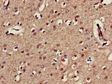 KIR3DL1 Antibody - Immunohistochemistry of paraffin-embedded human brain tissue at dilution of 1:100