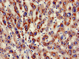 KIR3DL1 Antibody - Immunohistochemistry of paraffin-embedded human liver tissue at dilution of 1:100