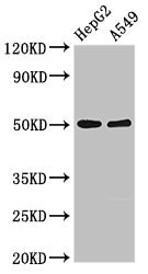 KIR3DL1 Antibody - Western Blot Positive WB detected in:HepG2 whole cell lysate,A549 whole cell lysate All Lanes:KIR3DL1 antibody at 2.5µg/ml Secondary Goat polyclonal to rabbit IgG at 1/50000 dilution Predicted band size: 50,39 KDa Observed band size: 50 KDa