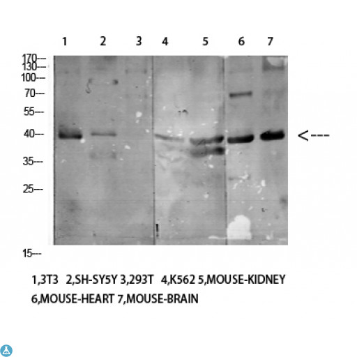 KIR3DL1 Antibody - Immunohistochemistry (IHC) analysis of paraffin-embedded Human Brain, antibody was diluted at 1:100.