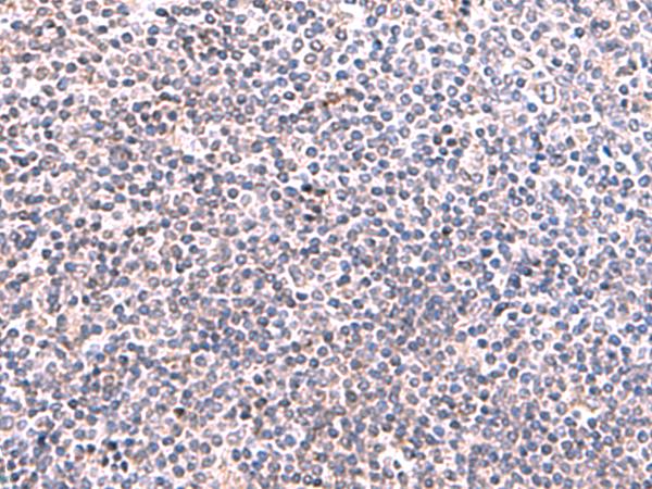 KIR3DL1 Antibody - Immunohistochemistry of paraffin-embedded Human tonsil tissue  using KIR3DL1 Polyclonal Antibody at dilution of 1:95(×200)